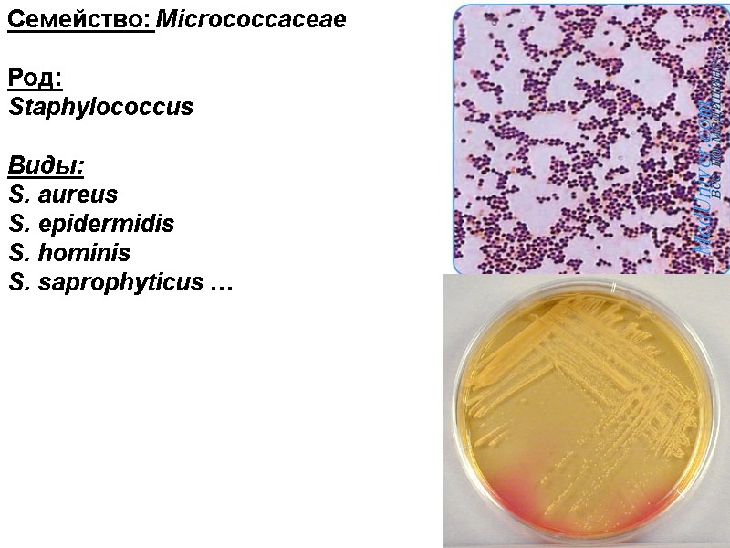 Семейство: Micrococcaceae  Род:  Staphylococcus  Виды: S. aureus  S. epidermidis 